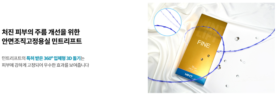 Fix Point Thread Lifting Using Mint Threads image 4