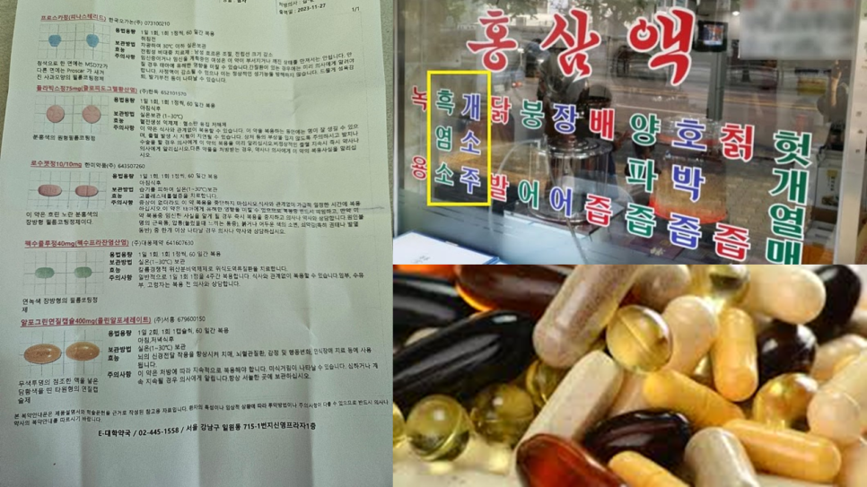 직장인 상하안검 수술, 연휴를 이용해 회복할 수 있을까? 관련 이미지 4