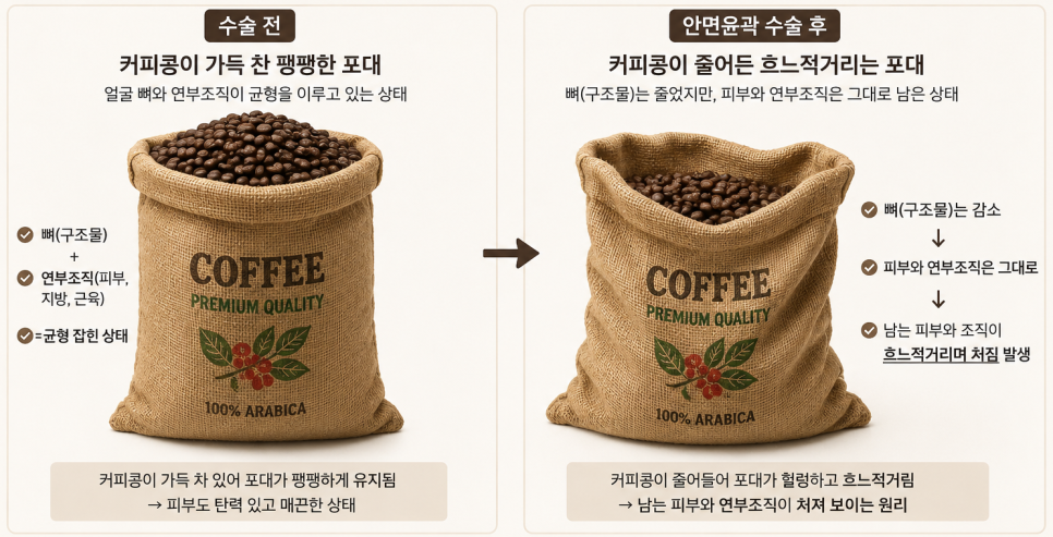 안면윤곽수술 후 피부처짐, 맞춤형 거상수술이 필요한 이유 관련 이미지 1
