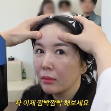 Jang Young-ran’s Brow Lift: Why It Made Her Look Younger, But Isn’t the Right Answer for Everyone image 3