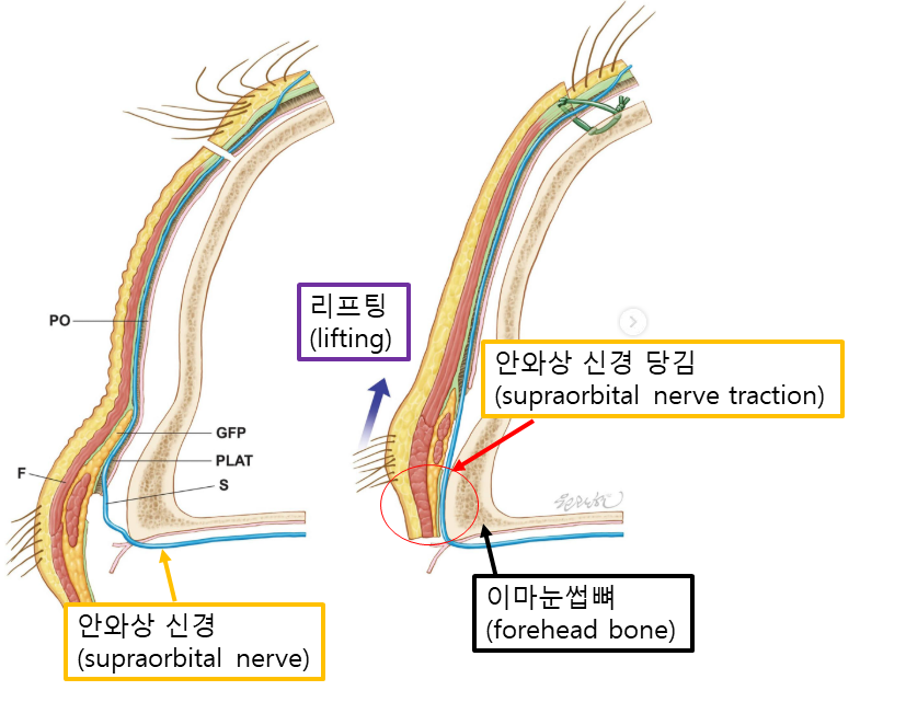 70대도 편하게 받는 내시경 이마거상 관련 이미지 4