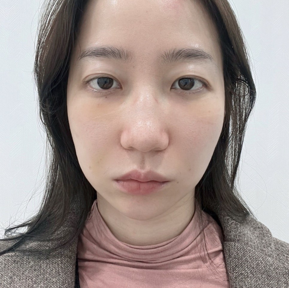 직장인들에게 가장 인기있는 성형 항목 관련 이미지 8