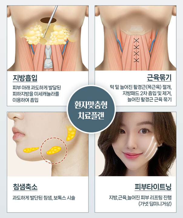 목 세로 주름의 교정 관련 이미지 6