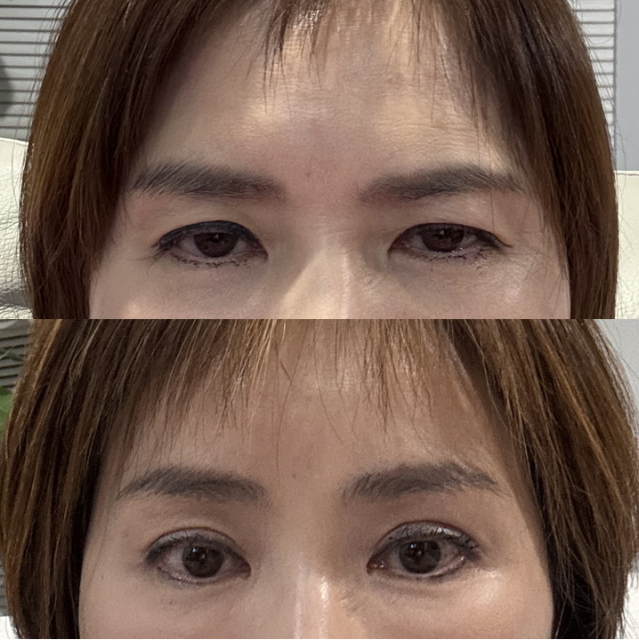 모델페이스 챌린지와 이마거상, 우아한 인상의 공통점 관련 이미지 6