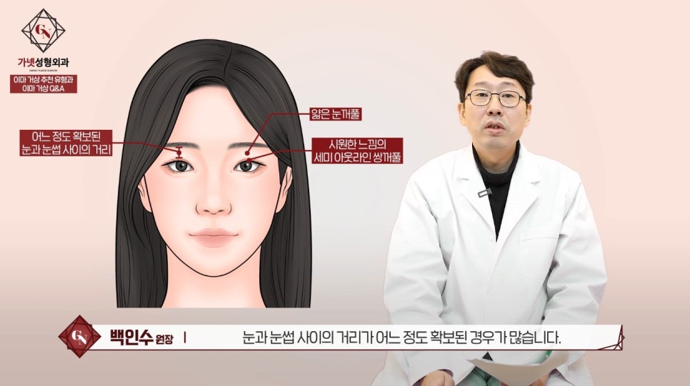 이마거상술잘하는곳에서 알아보는 이마거상 대박나는 유형! 관련 이미지 5
