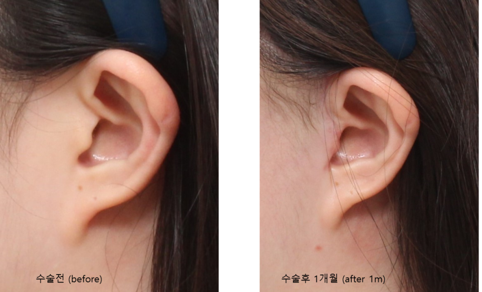 티 안 나게 확실하게 당긴다 – 히든 딥미니거상 관련 이미지 4