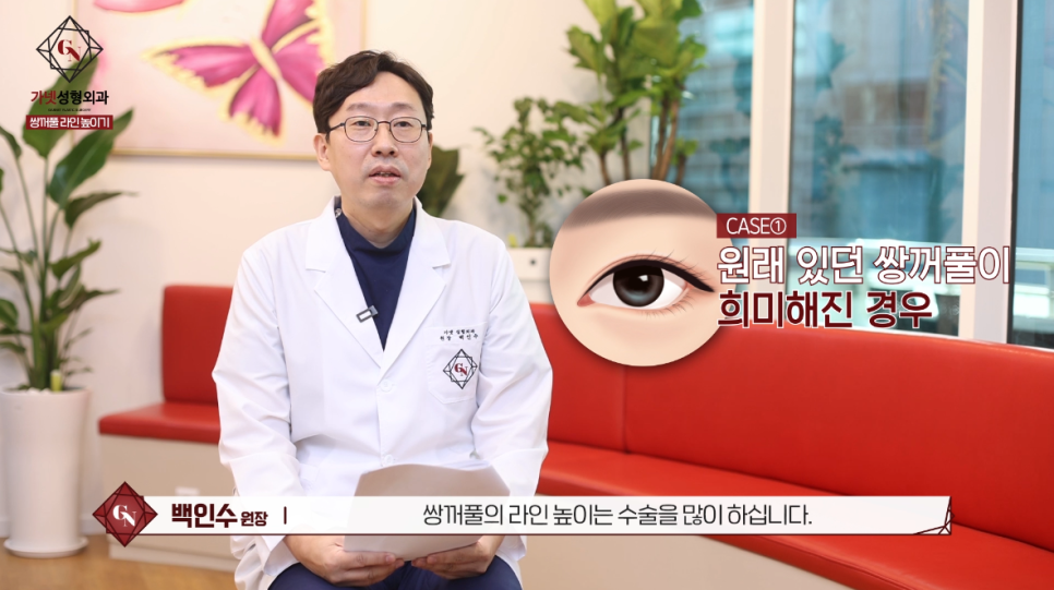 쌍꺼풀라인높이기 쌍수재수술 비결, 가넷성형외과에서 알아보세요! 관련 이미지 2