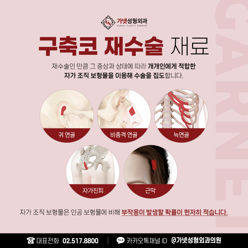 구축코재수술 잘하는병원의 재수술 성공 비결 관련 이미지 4
