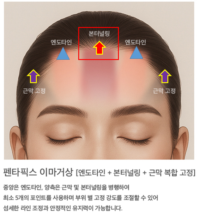 이마거상으로 화난 눈썹을 교정할 수 있을까요? 관련 이미지 3