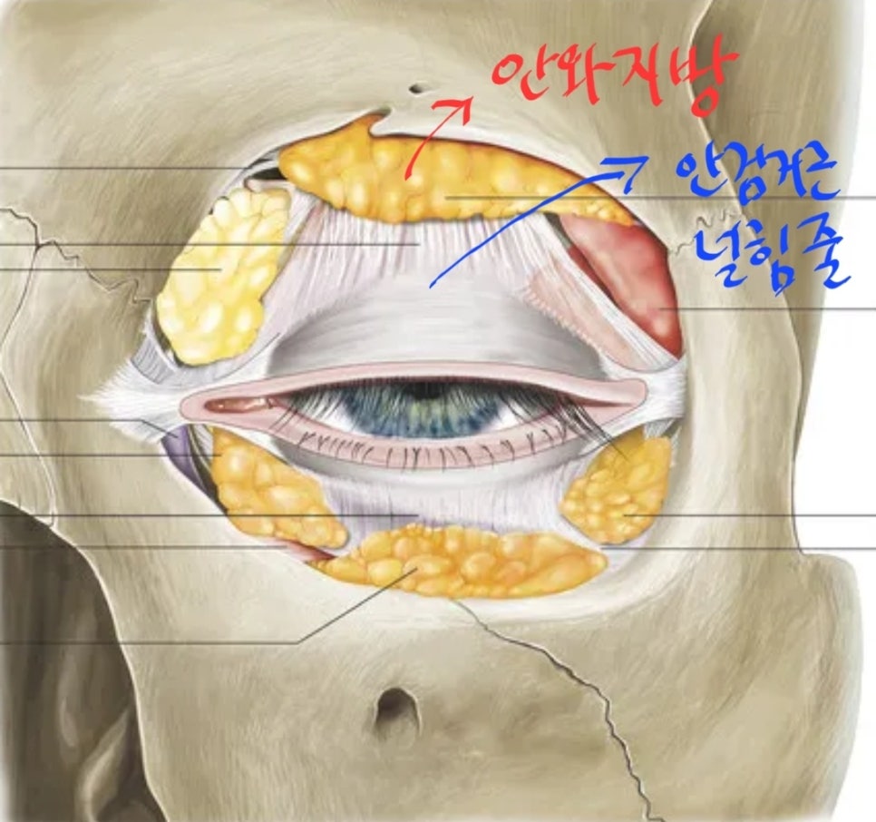쌍꺼풀 수술에서 겹주름과 꺼진 눈 교정 관련 이미지 3