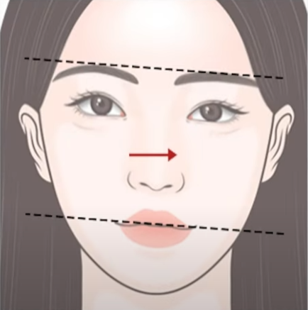 안면비대칭에서 코성형의 중요성 관련 이미지 1