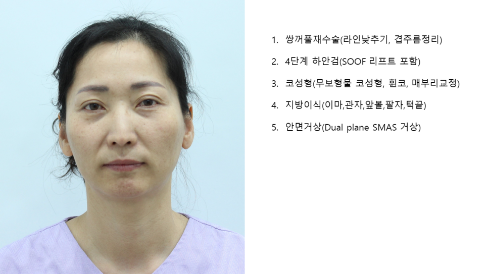 The Surgery Time and Recovery Period for Various Middle-Age Anti-Aging Surgeries image 2