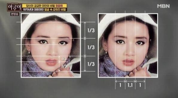 얼굴의 황금비율을 완성하는 이마축소술 관련 이미지 1