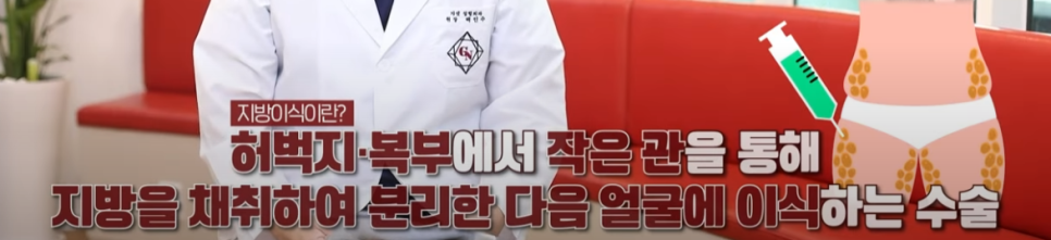 얼굴의 지방층 변화와 중년지방이식 관련 이미지 4