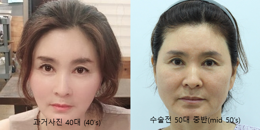결혼식 제2의 주인공을 위한 관련 이미지 2