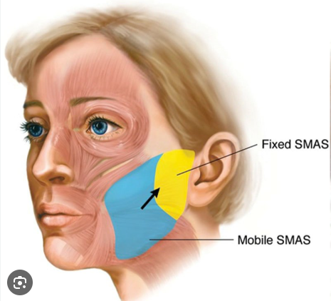 Natural Thread Lifting Using the Face’s Glide Planes image 1