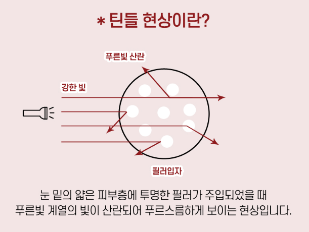 애교지방이식과 애교필러, 자연스러움과 유지기간의 차이 관련 이미지 1