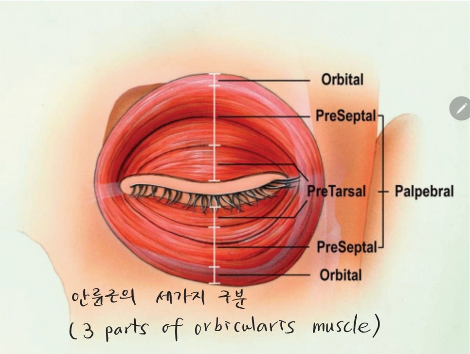 애교살 비대칭의 교정 방법 관련 이미지 2