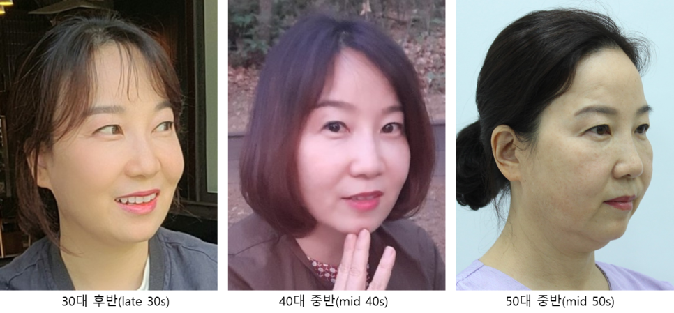 안티에이징 수술의 효과와 유지기간 관련 이미지 2