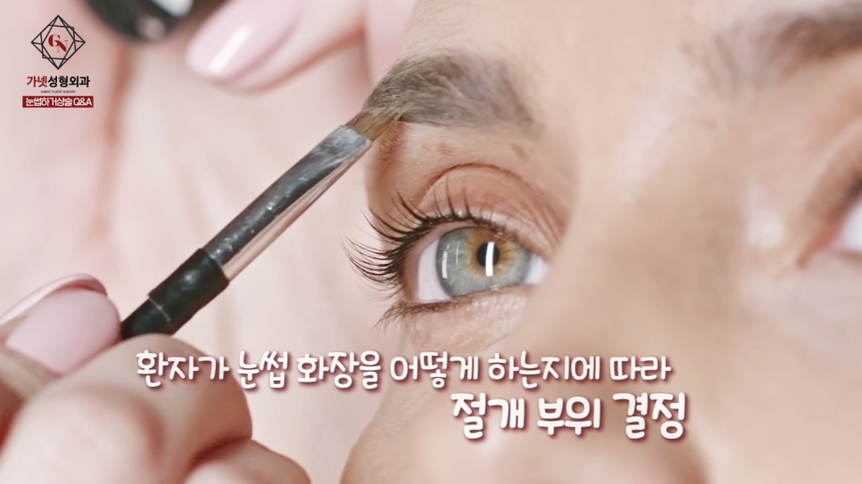 Differences Between Upper Eyelid Lift and Upper Blepharoplasty, and Brow Lift Scars: Explained by a Board-Certified Plastic Surgeon image 13