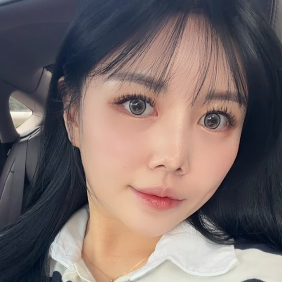 실리콘 부작용 구축코, 자가 늑연골 코재수술로 자연스럽게 복원하기 관련 이미지 6