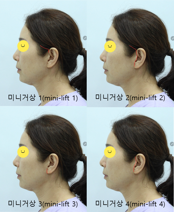 미니거상의 종류 관련 이미지 3