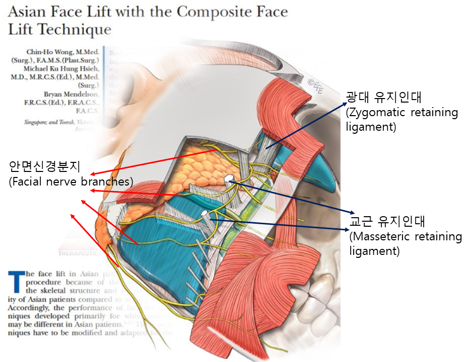 Cheek Sagging After Cheekbone Reduction Surgery? image 3