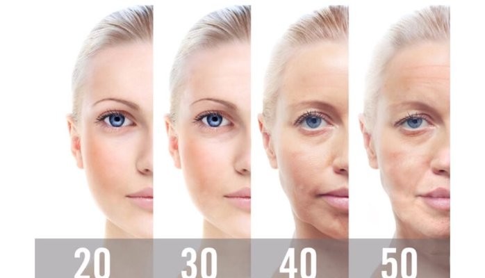 Areas of the Face Improved by a Deep Mini Facelift image 1