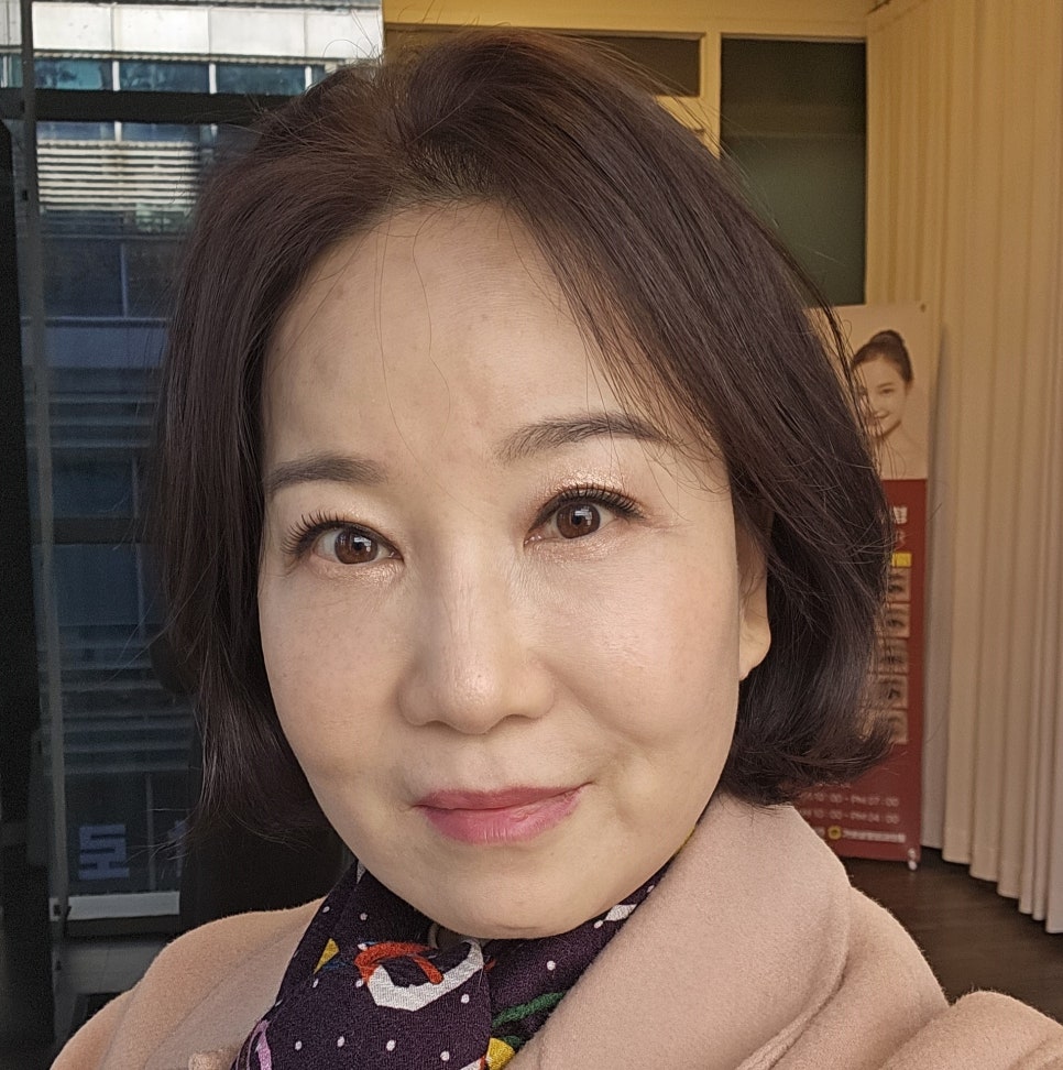 안티에이징 수술의 효과와 유지기간 관련 이미지 7