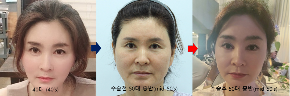결혼식 제2의 주인공을 위한 관련 이미지 8