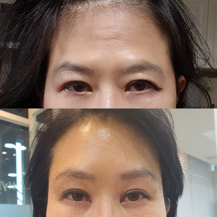 부드러운 인상을 만드는 이마거상술 관련 이미지 5