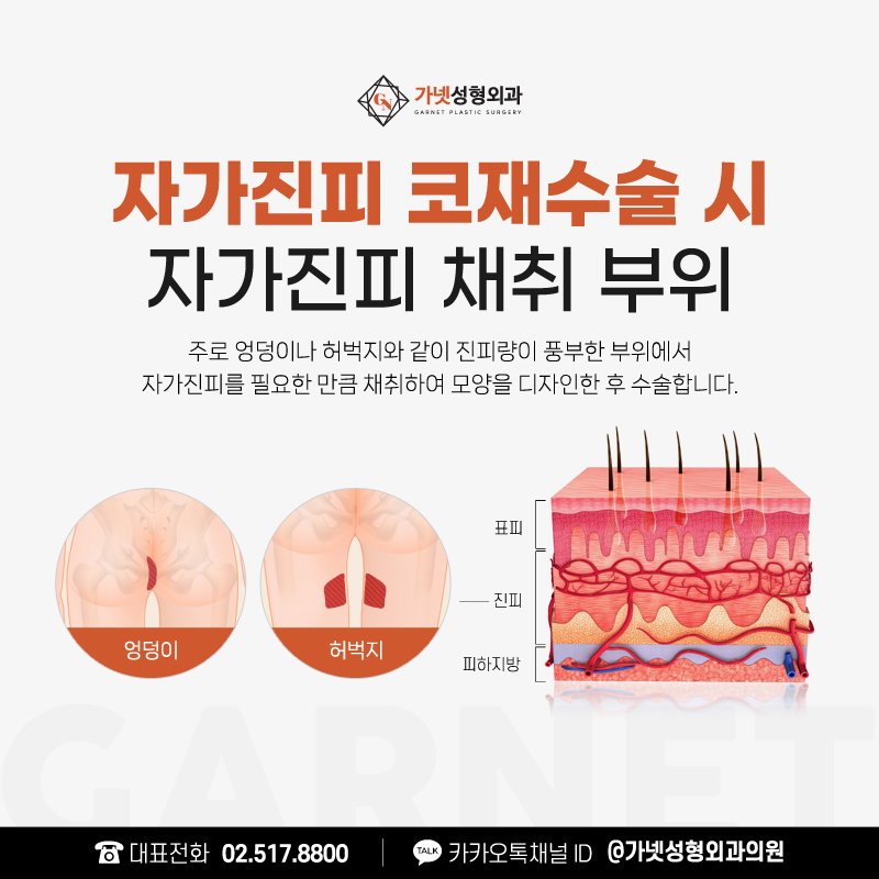 What to Consider for a Careful Decision About Nose Revision Surgery image 12