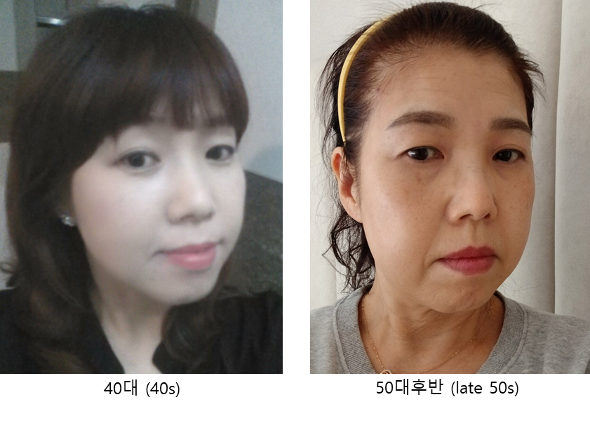 중년종합성형 상담과 수술의 범위 관련 이미지 1