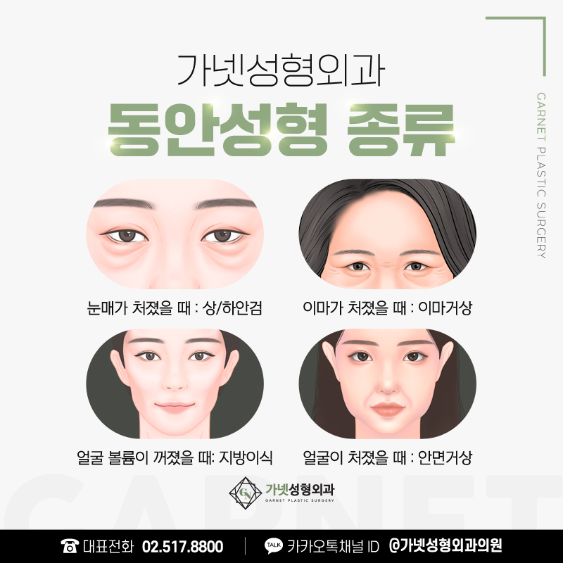 이마거상회복기간 수술방법 효과 이마거상전후 실제 사례로 확인! 관련 이미지 5