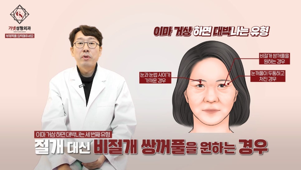 이마거상술잘하는곳에서 알아보는 이마거상 대박나는 유형! 관련 이미지 6