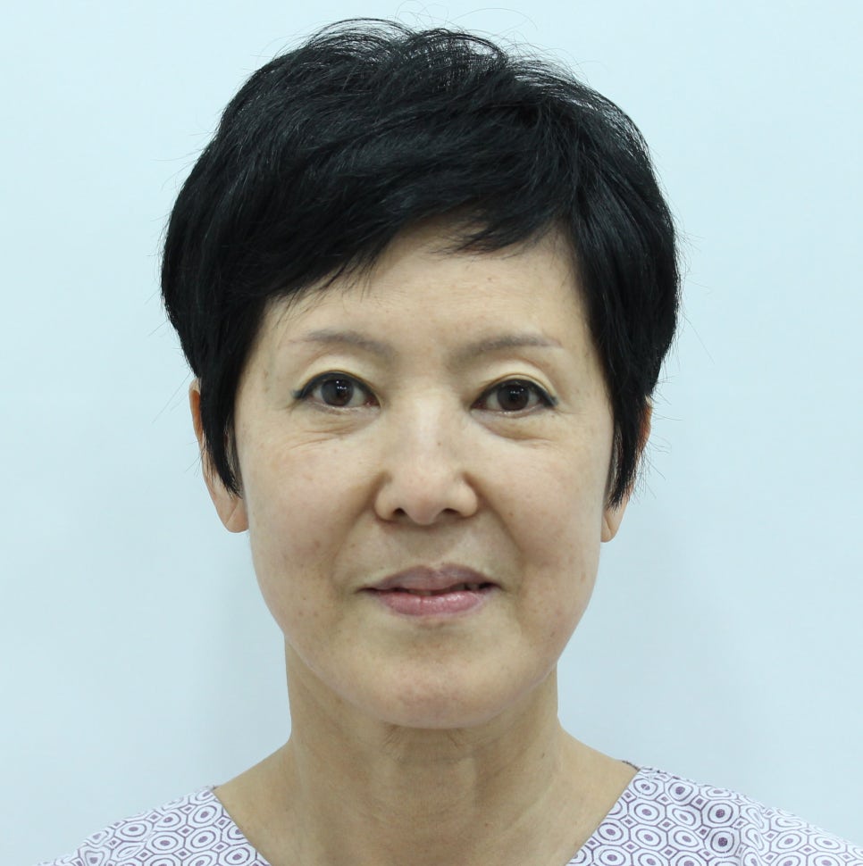 Deep Plane Facelift and Neck Lift image 2