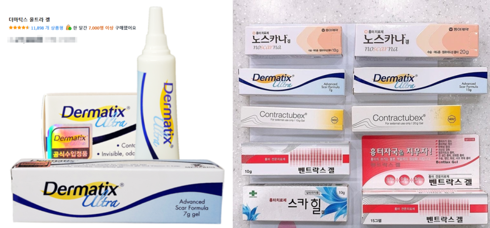 안면거상 후 흉터, 얼마나 남을까요? 흉터의 변화와 관리법 관련 이미지 2