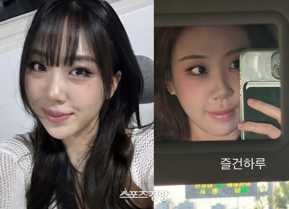 이영지 눈밑지방재배치, 시술일까 수술일까? 관련 이미지 2