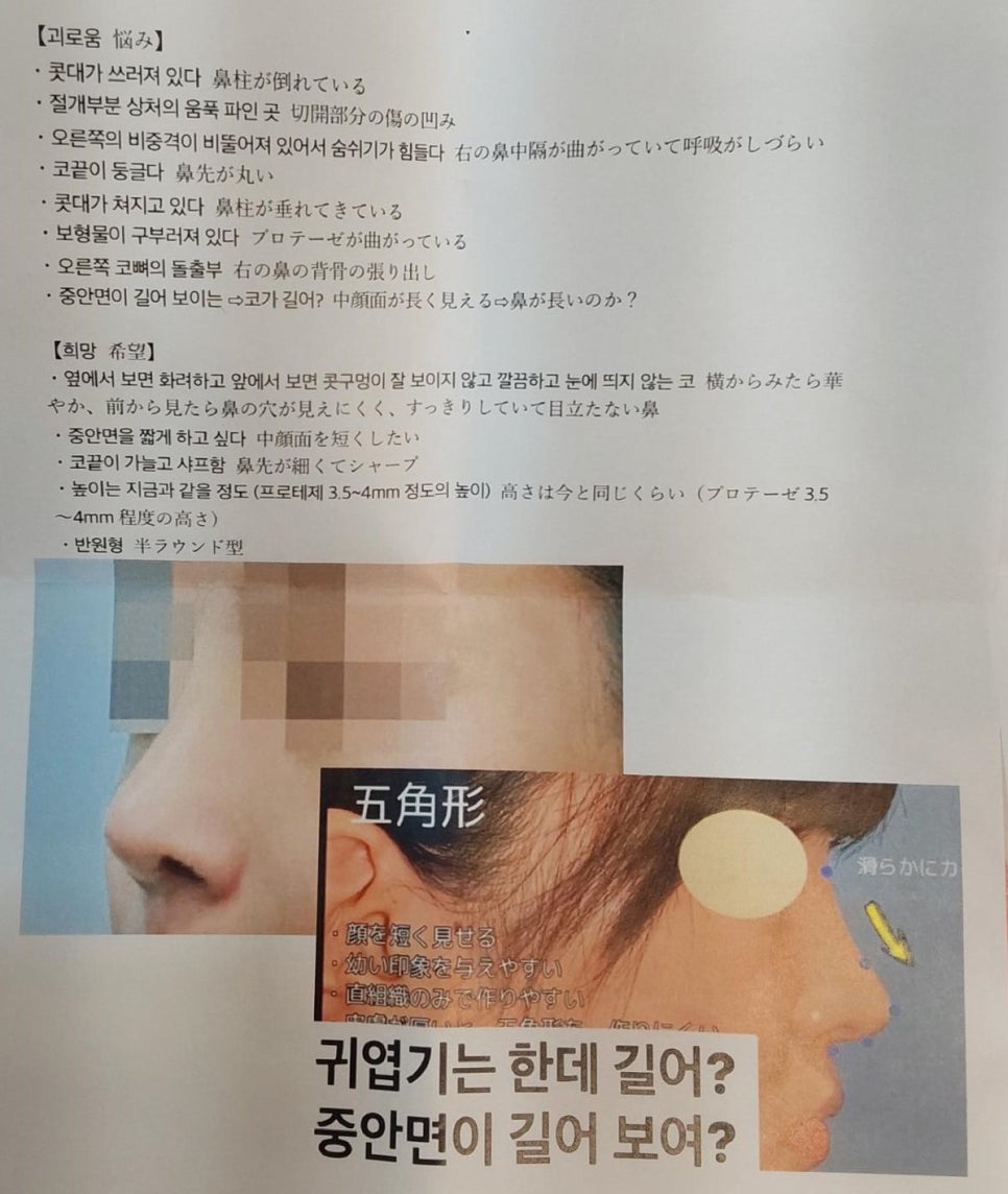 Consultation Process and Surgical Items for Revision Rhinoplasty image 5