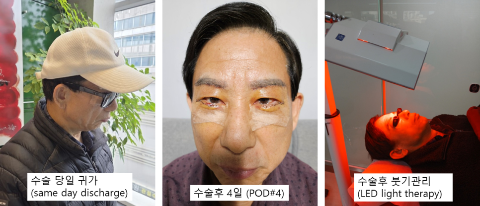 5월, 아버지께 드린 작은 변화 &ndash; 남자 눈썹하거상 관련 이미지 3