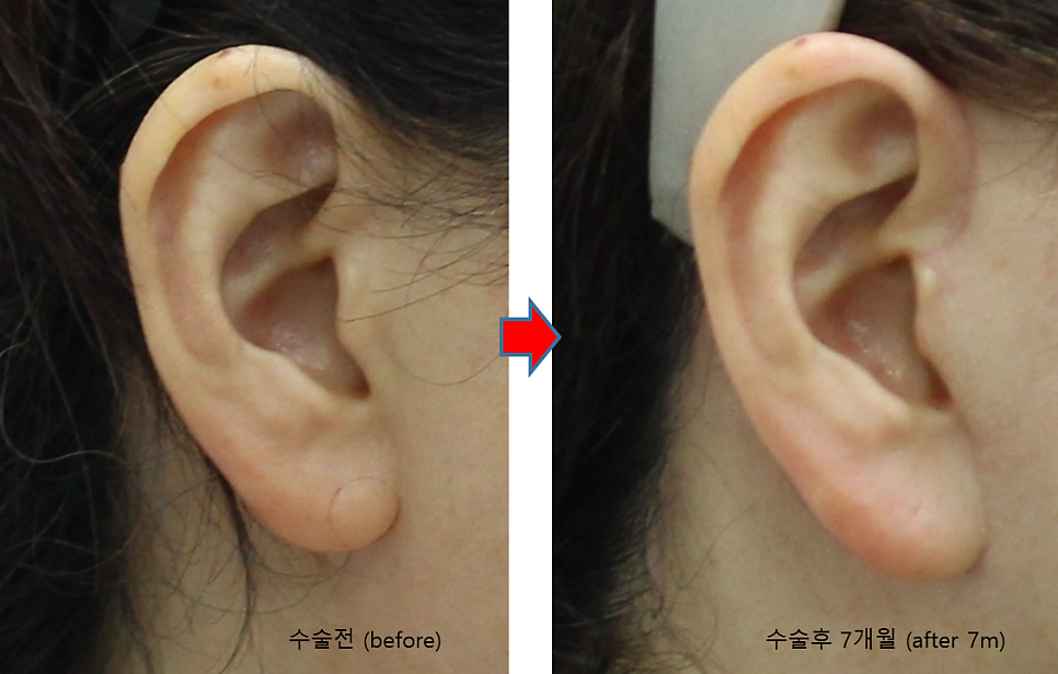 결혼식 제2의 주인공을 위한 관련 이미지 10