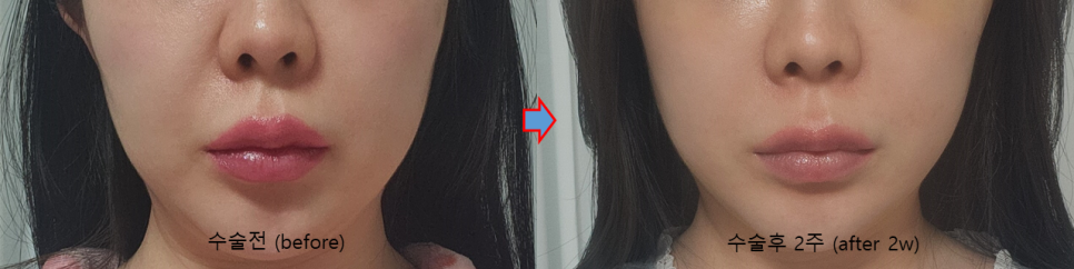 티 안 나게 확실하게 당긴다 – 히든 딥미니거상 관련 이미지 2