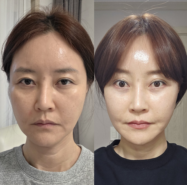 수직 미니거상, 정말 중요한 것은 관련 이미지 4