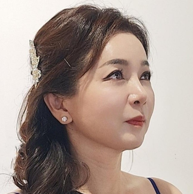안면거상후 흉터 성숙과정 관련 이미지 7