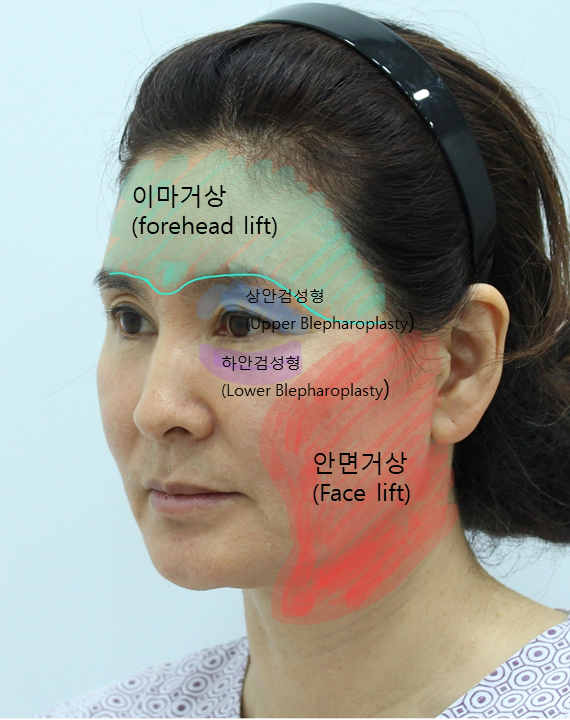 결혼식 제2의 주인공을 위한 관련 이미지 3