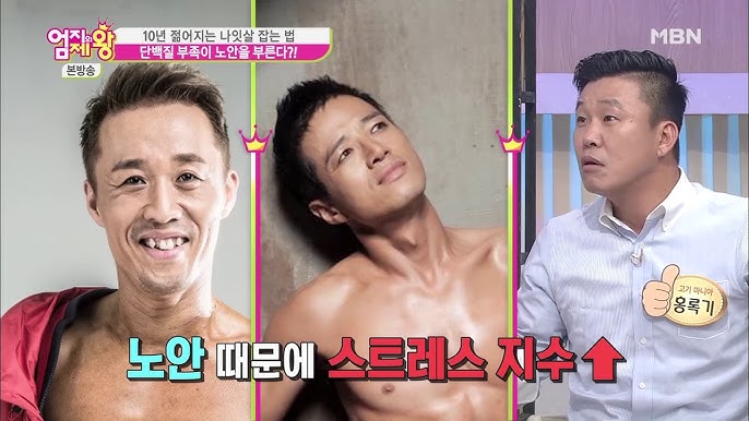 다이어트후 발생한 얼굴의 노화 관련 이미지 12