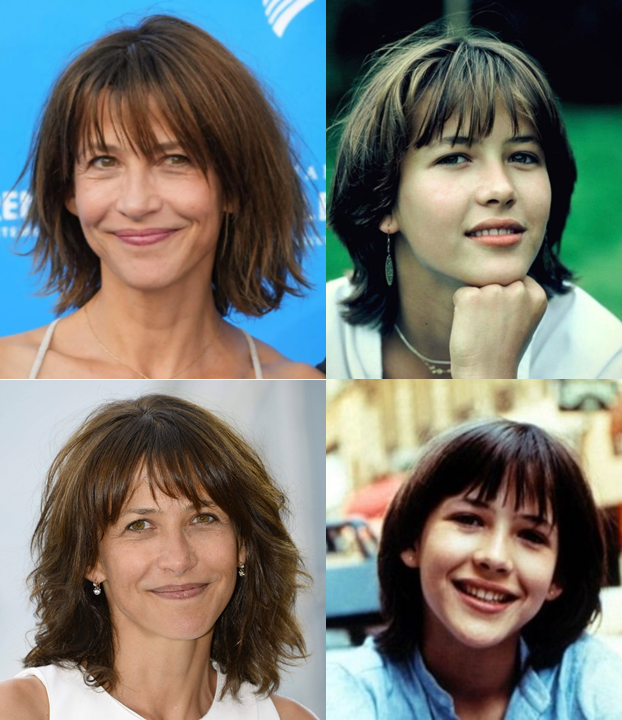 The Aging Process of the Nose and Midlife Rhinoplasty image 1