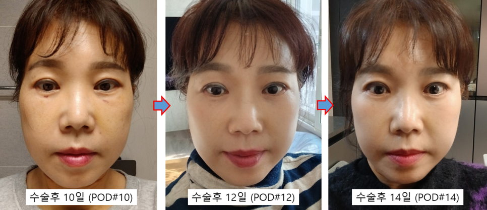 수술만큼 중요한 회복, 결과를 바꾸는 관리의 차이 관련 이미지 5