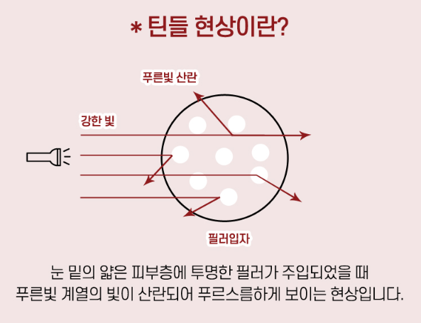 코필러 퍼짐과 필러비침현상(틴들현상) 관련 이미지 3