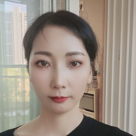 The Aging Process of the Nose and Midlife Rhinoplasty image 10